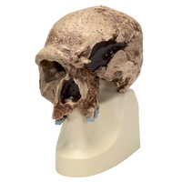 Anatomical Skull, Steinheim model